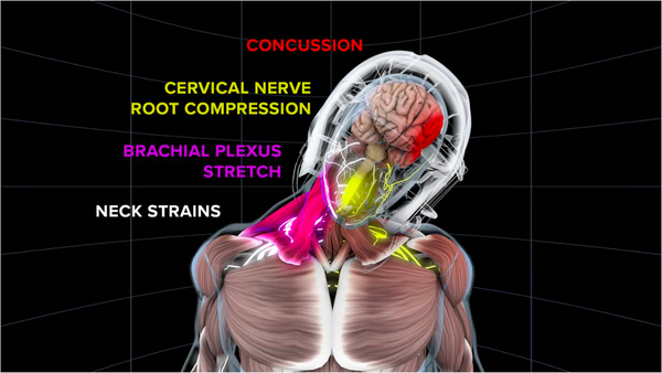 Without KATO - Unrestricted Movement